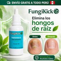 Gotas contra hongos de las uñas